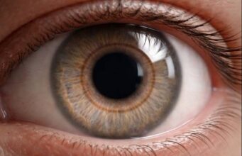 The Impact of Vossius Ring on Vision