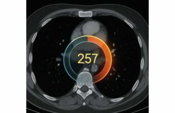 Coronary Artery Calcium for Longevity: Score, Risk, and Follow-Up