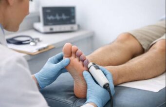 Blue toe syndrome causes and risk factors behind sudden toe discoloration