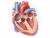 Bulboventricular foramen defect: What It Is, Risk Factors, Symptoms, Diagnosis, and Care Plan