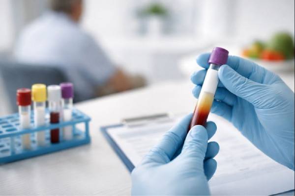 Hyperchylomicronemia: Causes, Pancreatitis Risk, and Treatment Strategies