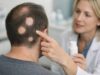 Deuruxolitinib (Leqselvi) for alopecia areata: learn expected results, side effects, safety monitoring, and who may benefit from this oral JAK inhibitor.
