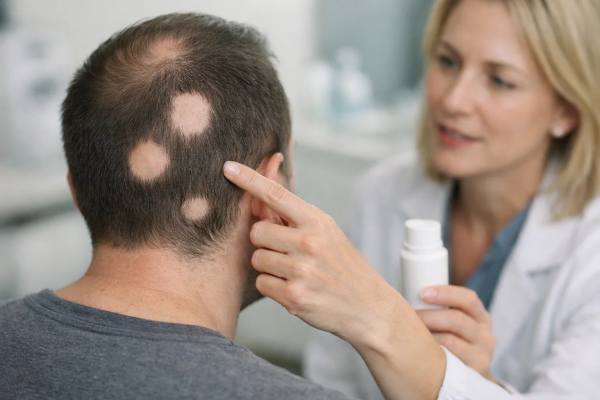 Deuruxolitinib (Leqselvi) for Alopecia Areata: Results, Side Effects, and Who It’s For Deuruxolitinib (Leqselvi) for alopecia areata: learn expected results, side effects, safety monitoring, and who may benefit from this oral JAK inhibitor.