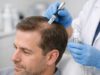 Exosome therapy for hair loss: what it is, realistic results, clinical evidence, and safety red flags to know before booking treatment.