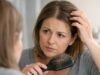 Hair Loss After Starting or Stopping SSRIs: Timeline, Triggers, and What to Check Hair loss after starting or stopping SSRIs? Learn the telogen effluvium timeline, key triggers, labs to check, and safe next steps for recovery.