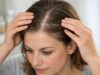 Hair Loss From Scalp Psoriasis: Why It Happens and How to Regrow Hair