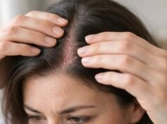 Hair loss and scalp inflammation often go together. Learn the warning signs, common causes, and how early treatment can reduce shedding and protect follicles.