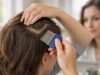 Learn how to treat head lice effectively, time repeat steps correctly, and prevent reinfestation at home and school with a calm, practical plan.
