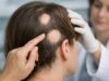 Learn how JAK inhibitors treat alopecia areata, which drugs are approved, expected regrowth timelines, key risks, and required lab monitoring.