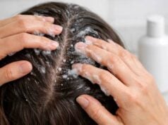Salicylic Acid for Scalp: Flakes, Buildup, and Safe Frequency