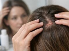 Saw Palmetto for Hair Loss: Benefits, Risks, and Drug Interactions