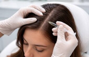 Scalp Mesotherapy for Hair Loss: Ingredients, Evidence, and Risks