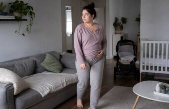 Postpartum Weight Loss After a C-Section Postpartum weight loss after a C-section: learn when to start, how to eat for healing, when to exercise safely, what slows progress, and how to lose weight realistically after cesarean birth.