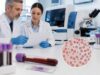 Learn the typical PDW normal range, what high or low platelet distribution width means, and how PDW fits with platelet count, MPV, plateletcrit, and CBC results.