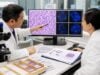 BCL6 Rearrangement Test: Lymphoma, Prognosis, and Results Learn what a BCL6 rearrangement test shows, how positive and negative results are interpreted, and how BCL6, MYC, and BCL2 findings affect lymphoma classification and prognosis.