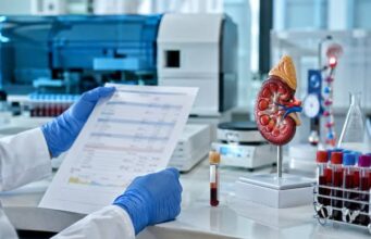 Bicarbonate Blood Test Normal Range: Reference Values and Meaning Learn the normal bicarbonate blood test range, what low or high CO2/HCO3 results mean, and how kidneys, lungs, electrolytes, and the anion gap affect interpretation.