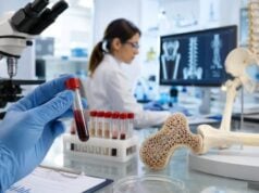 Learn what the BSAP blood test measures, what high bone-specific alkaline phosphatase means, common causes, normal ranges, related bone markers, and follow-up steps.