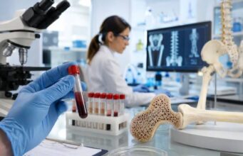 Learn what the BSAP blood test measures, what high bone-specific alkaline phosphatase means, common causes, normal ranges, related bone markers, and follow-up steps.