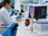 Learn what a high 1,25-dihydroxy vitamin D test means, including calcitriol causes, calcium risk, granulomatous disease, lymphoma, PTH patterns, and follow-up tests.