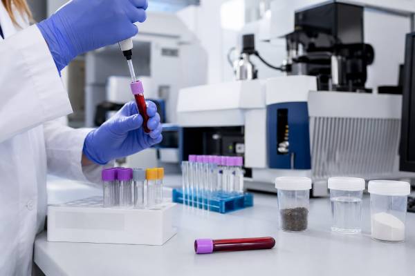 High Chromium Blood Test: Causes, Exposure, Toxicity, and Meaning Learn what a high chromium blood test means, including common causes, normal ranges, metal implant issues, chromium toxicity risks, symptoms, and next steps.