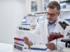 High ferritin with liver enzymes can signal inflammation, fatty liver disease, alcohol-related liver stress, or iron overload. Learn how transferrin saturation, ALT, AST, GGT, bilirubin, and follow-up testing help clarify the cause.