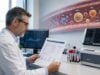 Learn what a lipoprotein fractionation test measures, including LDL-P, HDL, VLDL, IDL, particle size, remnants, and how results relate to cardiovascular risk.