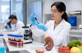 Low Uric Acid Blood Test: Causes, Kidney Loss, Diet, and Meaning Low uric acid can reflect kidney uric acid loss, diet, medicines, SIADH, Fanconi syndrome, or inherited renal hypouricemia. Learn causes, risks, and follow-up tests.