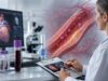 Learn what the myeloperoxidase MPO test measures, what high MPO means, common MPO ranges, artery inflammation links, plaque risk, causes, and follow-up steps.