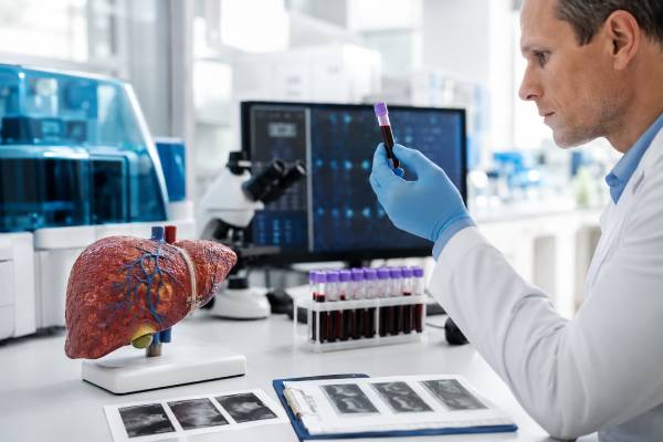 Procollagen III N-Terminal Peptide (PIIINP) Test: High PIIINP, Liver Fibrosis, Normal Range, and Results Learn what the PIIINP blood test measures, why high PIIINP can suggest liver fibrosis activity, how normal ranges vary, and how results fit with ELF, FIB-4, liver enzymes, and elastography.