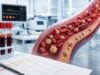 Understand remnant cholesterol and triglycerides, how to calculate results, what high levels mean, and how they reveal residual heart risk beyond LDL cholesterol.
