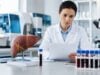 Tissue Inhibitor of Metalloproteinase-1 (TIMP-1) Test: Liver Fibrosis Marker, High Levels, and Results Learn what the TIMP-1 blood test measures, why high TIMP-1 can be linked to liver fibrosis, how ELF scores use TIMP-1, and what abnormal results may mean.