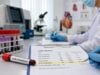 Learn the normal VLDL cholesterol range, how VLDL is calculated from triglycerides, what high or low results mean, and when follow-up testing matters.