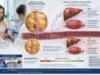 Adiponectin Blood Test: Low Levels, Insulin Resistance, and Results Learn what an adiponectin blood test measures, why low levels may accompany insulin resistance, how ranges vary, and what high or abnormal results can mean.
