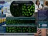 Understand what a positive or negative antinuclear antibody test means, how ANA titer and pattern affect interpretation, and which follow-up tests may clarify autoimmune risk.