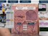 Understand autoimmune blistering disease panels, including desmoglein, BP180, BP230, collagen VII, biopsy, and immunofluorescence findings used to diagnose pemphigus and pemphigoid.