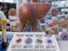 Understand how AMA, SMA, LKM-1, ANA, SLA, and related antibodies help evaluate autoimmune hepatitis, primary biliary cholangitis, overlap disease, and abnormal liver tests.