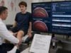 Learn how Becker muscular dystrophy genetic testing detects DMD deletions, duplications, and sequence variants, and what results mean for weakness, heart care, and family risk.