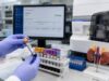 Understand what a DHEA-S blood test shows, normal ranges by age and sex, causes of high or low adrenal androgen levels, and the follow-up tests used to interpret results.