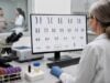 Understand Down syndrome genetic testing, including trisomy 21 screening, CVS and amniocentesis diagnosis, chromosome results, recurrence, and next steps.