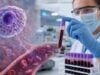 Learn what a histamine blood test measures, why timing and specimen handling matter, what high levels may mean, and why tryptase or urine markers are often preferred.