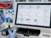 Learn what positive, negative, and indeterminate lupus anticoagulant tests mean, how they relate to clotting risk and APS, and why repeat testing matters.