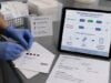 Understand newborn SMA screening, SMN1 and SMN2 results, confirmatory testing, early treatment decisions, missed variants, and family planning after an abnormal result.