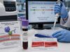 Learn what a phosphatidylserine-prothrombin antibody test measures, how IgG and IgM results relate to APS and clotting risk, and why context and repeat testing matter.