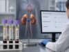Learn what plasma epinephrine, norepinephrine, and dopamine results mean, why collection posture matters, common causes of high values, and when metanephrine testing is preferred.
