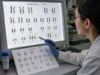 A prenatal karyotype diagnoses chromosome number and structural abnormalities. Learn how CVS or amniocentesis results are written, what mosaicism means, and when other tests are needed.
