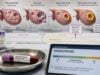 Understand progesterone blood test timing, normal ranges, ovulation thresholds, and possible causes of high or low results in menstrual cycles, fertility care, and pregnancy.