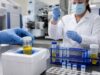 Prostaglandin D2 Test: Mast Cell Activation, High Levels, and Meaning Learn what a prostaglandin D2 urine metabolite test measures, how random and 24-hour collections differ, and what high, normal, or medication-affected results may mean.