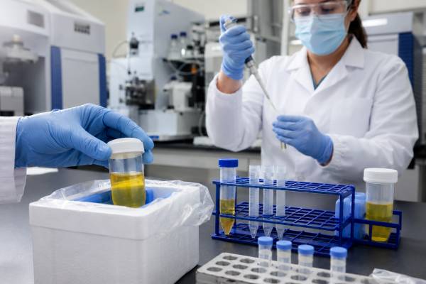 Learn what a prostaglandin D2 urine metabolite test measures, how random and 24-hour collections differ, and what high, normal, or medication-affected results may mean.