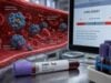 Sex Hormone-Binding Globulin (SHBG) Test: High, Low, Normal Range, and Results Learn what high or low SHBG blood test results mean, how SHBG changes free testosterone, common causes, normal-range limits, and appropriate follow-up testing.