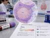 Thyroid Peroxidase Antibody (TPOAb) Test: Hashimoto Thyroiditis, Graves Disease, and Results Understand positive and negative TPOAb results, Hashimoto and Graves associations, normal thyroid function, pregnancy risks, and when follow-up is needed.